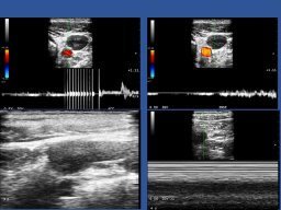 diapositiva2