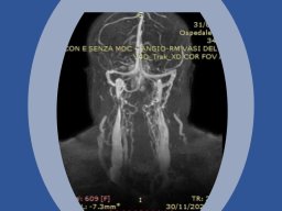 diapositiva29