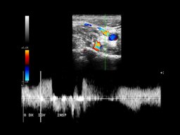 diapositiva15