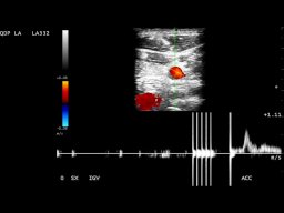 diapositiva16