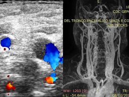 diapositiva34