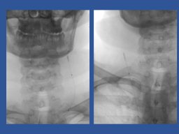 diapositiva41