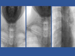 diapositiva55