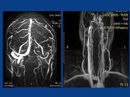 diapositiva19