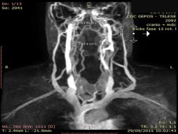 diapositiva17