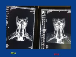 diapositiva32