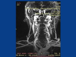 diapositiva37