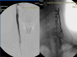 diapositiva38