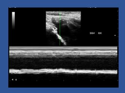 diapositiva35