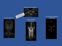 diapositiva49