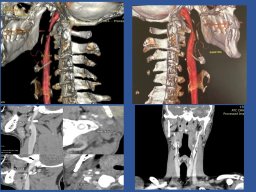 diapositiva58