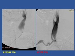 diapositiva79