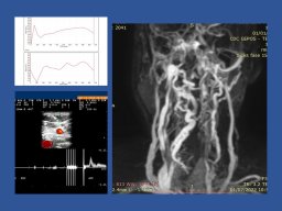 diapositiva66