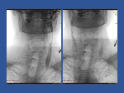 diapositiva68