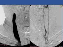diapositiva79
