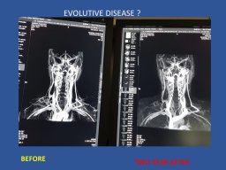 diapositiva80