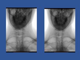 diapositiva85