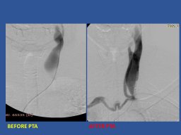 diapositiva88