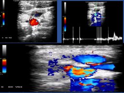 diapositiva37