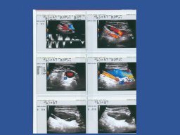 diapositiva38