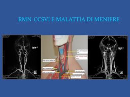 diapositiva39