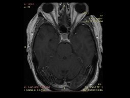 diapositiva44