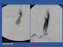 diapositiva67