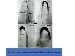 diapositiva68