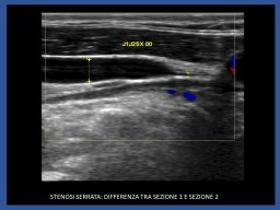 diapositiva18