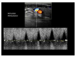 diapositiva20