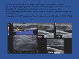 diapositiva24