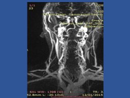 diapositiva42