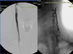 diapositiva43