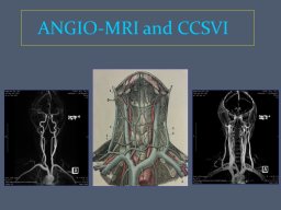 diapositiva16