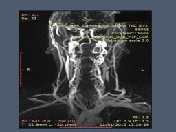 diapositiva22